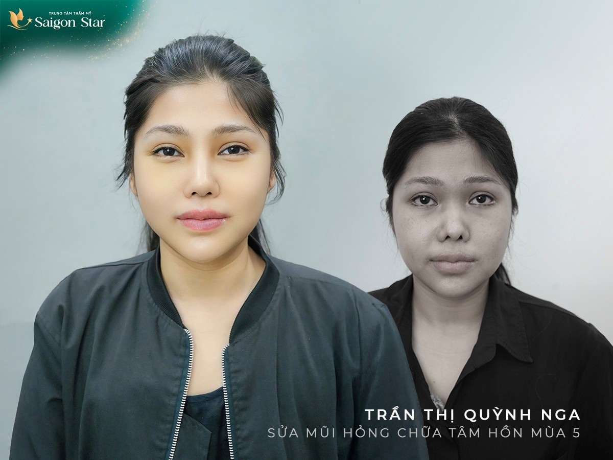 “Sửa Mũi Hỏng, Chữa Lành Tâm Hồn – Hành Trình Nhân Văn Của Bác Sĩ Hoạt” - ảnh 3