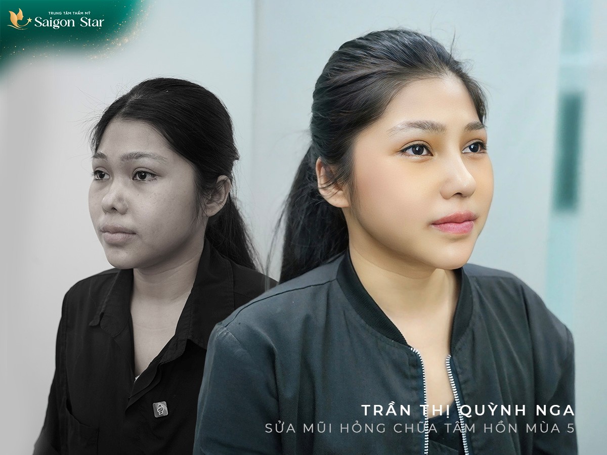 “Sửa Mũi Hỏng, Chữa Lành Tâm Hồn – Hành Trình Nhân Văn Của Bác Sĩ Hoạt” - ảnh 2