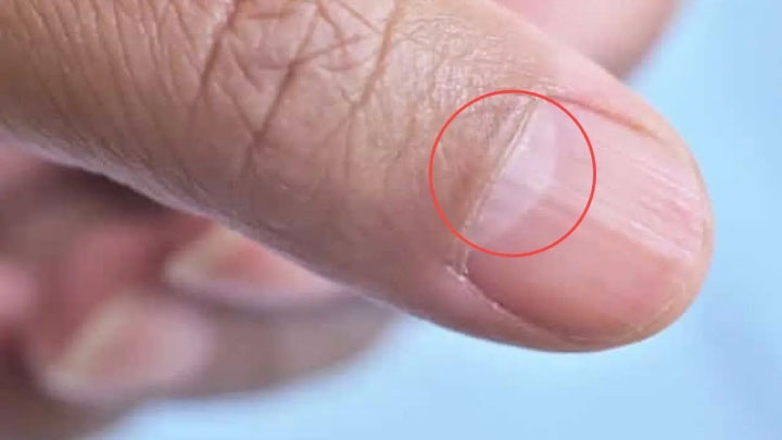 Trên ngón cái của mỗi người thường có một hình dạng giống lưỡi liềm ở phần gốc (Ảnh minh họa)