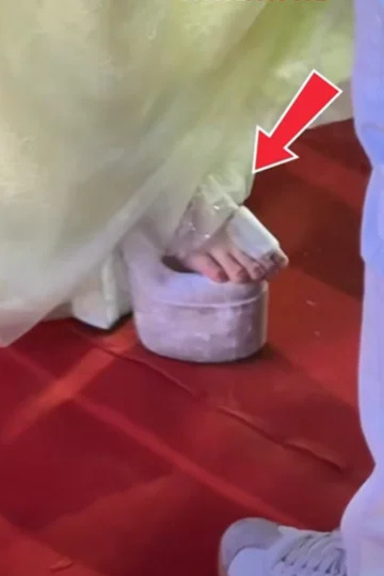 Vết thương ở chân của Hòa Minzy