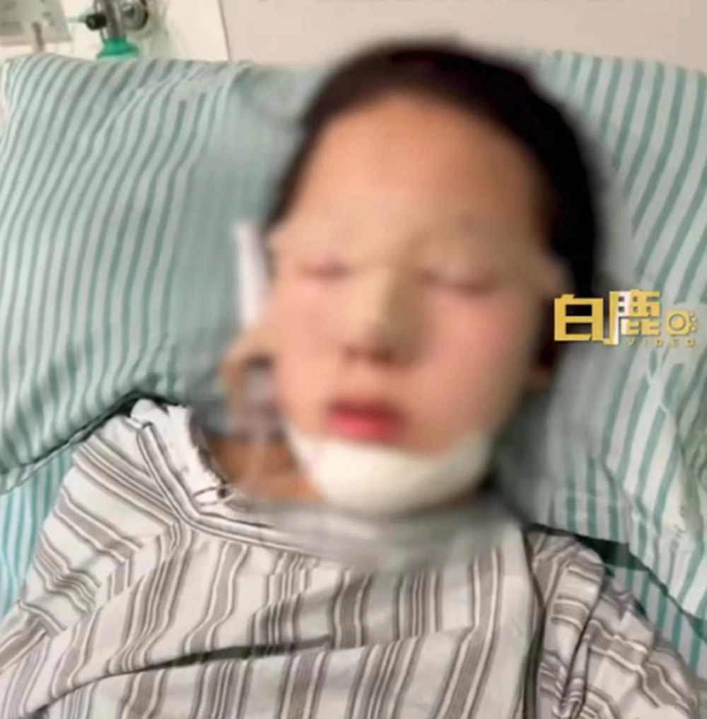 Cô con gái nằm trên giường bệnh sau khi phẫu thuật