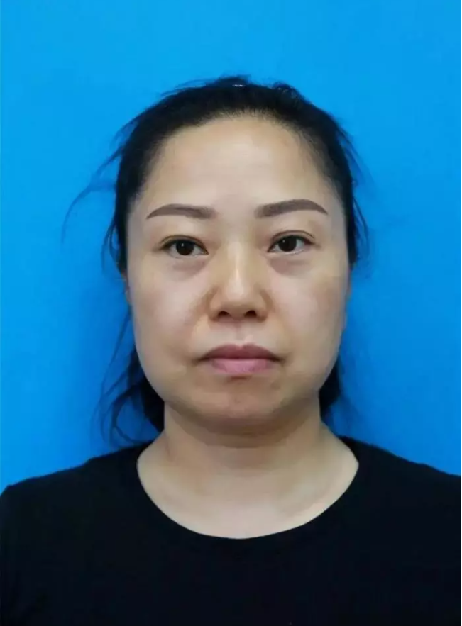 Hình ảnh trước khi thực hiện phương pháp làm đẹp của người phụ nữ Trung Quốc, ở tuổi 47, gương mặt cô đã có phần chảy xệ, nếp nhăn ở mắt, khóe miệng rõ (Ảnh: Internet)