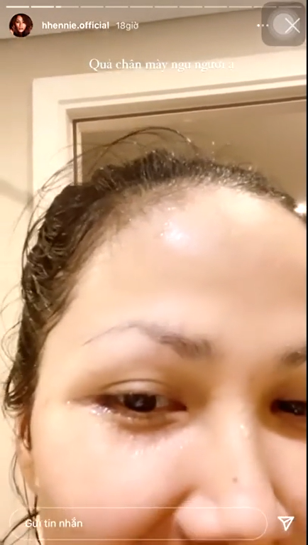 Dàn mỹ nhân Vbiz và những pha 'tự hủy' nhan sắc với lông mày khiến netizen “bật ngửa” - ảnh 2