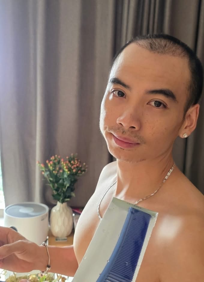 Diện mạo chồng H'Hen Niê sau nửa năm trị hói đầu - ảnh 2