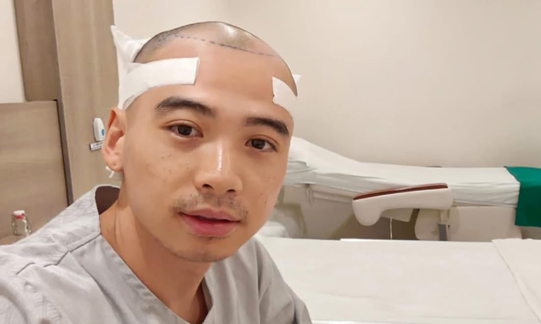 Diện mạo chồng H'Hen Niê sau nửa năm trị hói đầu - ảnh 4