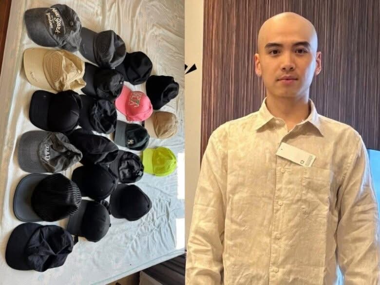 Diện mạo chồng H'Hen Niê sau nửa năm trị hói đầu - ảnh 5