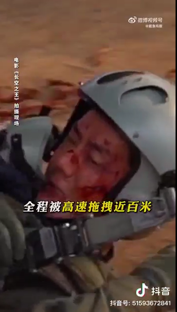 Nam diễn viên nổi tiếng Hoa Ngữ - Vương Nhất Bác gặp tai nạn ngoài ý muốn trên phim trường - ảnh 4