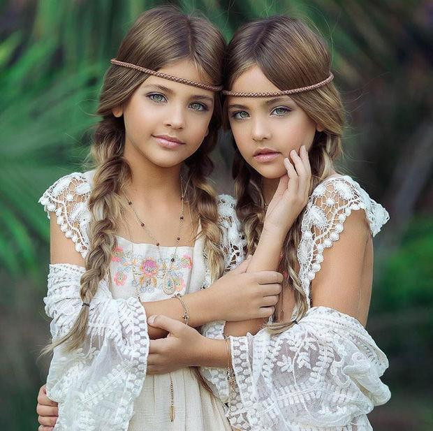 Cặp sinh đôi có đôi “mắt biếc” đẹp nhất thế giới, nhan sắc lúc lớn như tạc tượng khiến triệu người chao đảo - ảnh 2