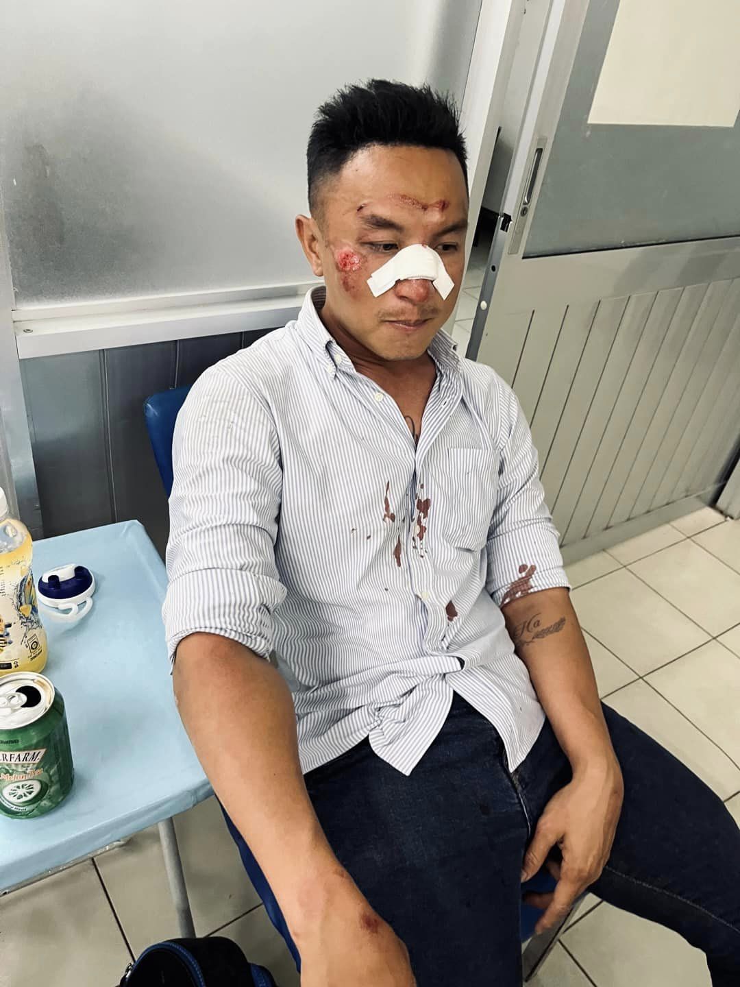 Hình ảnh nam MC Trương Việt Phong thương tích đầy người vì bị tai nạn giao thông khiến nhiều người hoang mang.