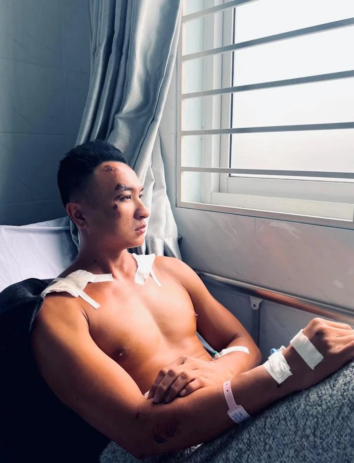 Thời điểm này năm ngoái, Trương Việt Phong gặp tai nạn giao thông và phải trải qua cuộc đại phẫu.