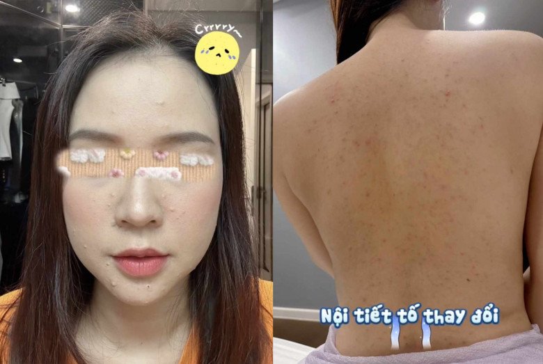 Vừa công bố mang thai, Sam để lộ tình trạng sức khỏe đáng lo, tiết lộ không dám ra đường - ảnh 3