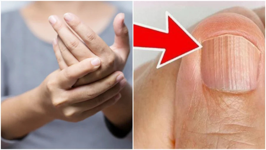 Thấy bàn tay có 1 trong 3 dấu hiệu này thì nên thận trọng bởi rất có thể là khối u ác tính? - ảnh 1