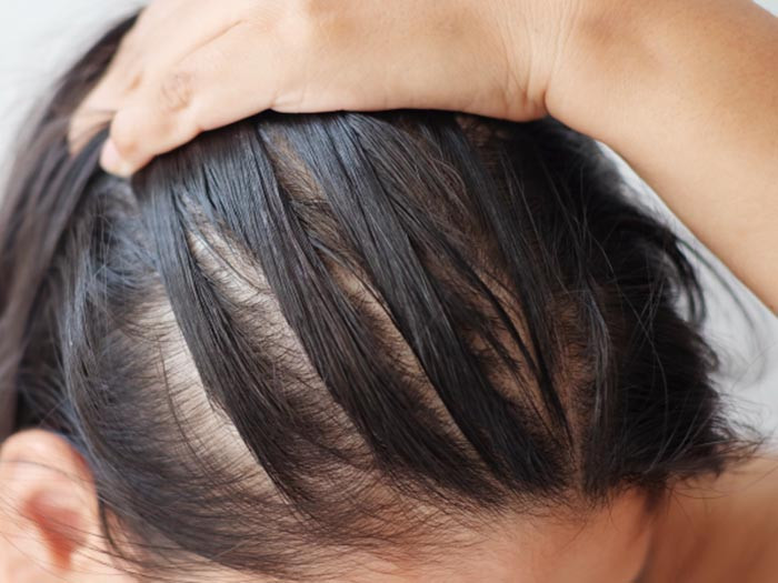 Nhiều người rụng tóc nhiều không rõ nguyên nhân, ăn 5 loại thực phẩm này, ngăn ngừa tóc rụng, phục hồi hư tổn - ảnh 2