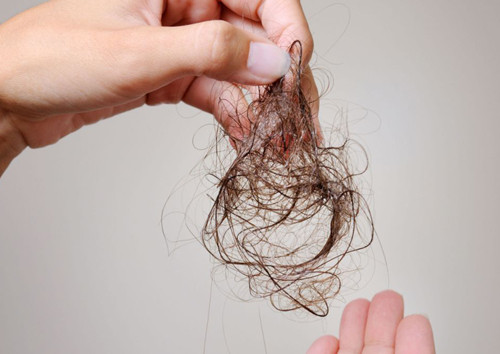 Nhiều người rụng tóc nhiều không rõ nguyên nhân, ăn 5 loại thực phẩm này, ngăn ngừa tóc rụng, phục hồi hư tổn - ảnh 1