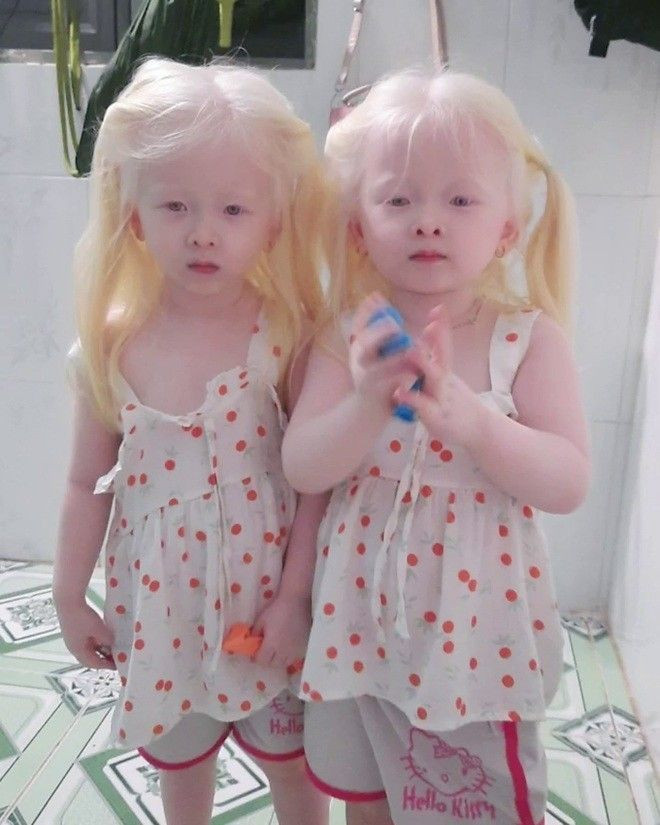 Hình ảnh cặp sinh đôi có màu tóc trắng cùng màu mắt đặc biệt, đáng yêu như thiên thần