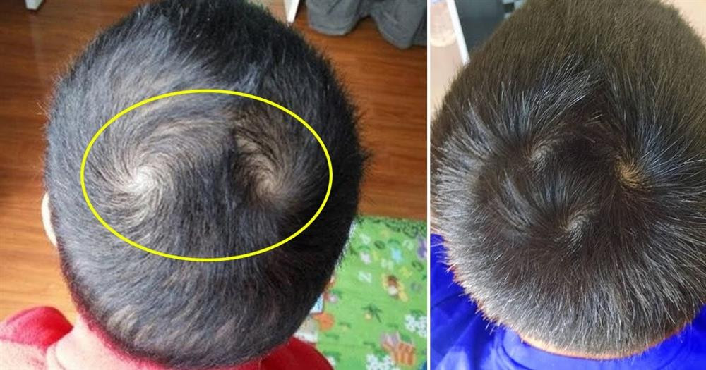 Thực hư trẻ em có 2 xoáy tóc rõ trên đầu khả năng thông minh hơn người khác