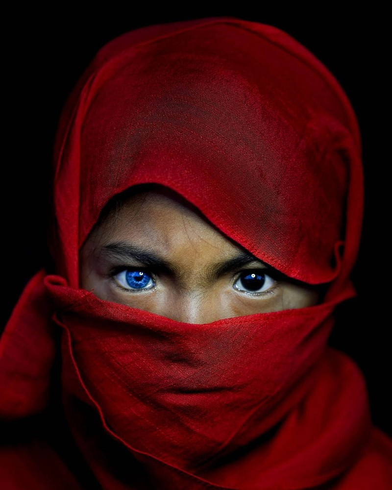 Một số trường hợp có người trong bộ tộc có mỗi mắt một màu khác nhau.