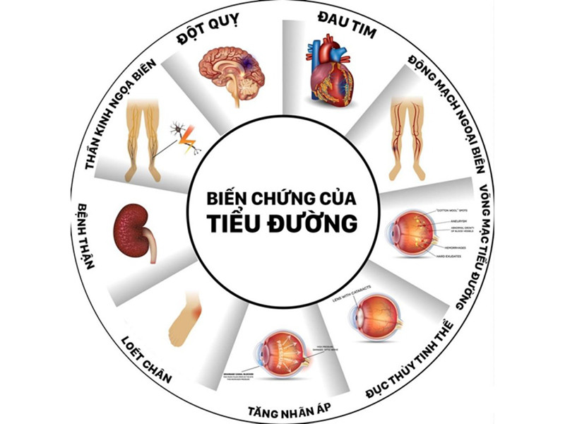 Phát hiện sớm dấu hiệu của bệnh tiểu đường qua biểu hiện này, ai cũng nên biết - ảnh 1