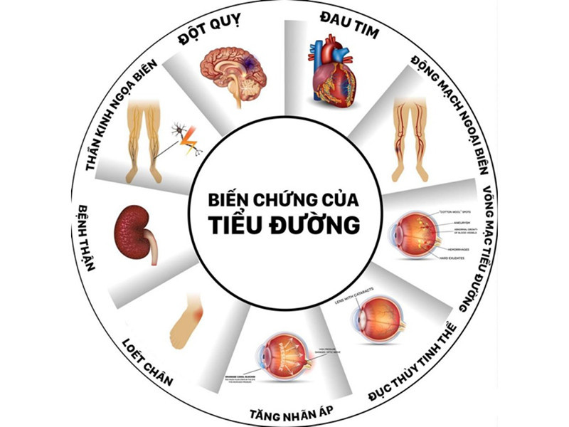 Tưởng nhầm khát nước do nắng nóng, đi khám phát hiện mắc bệnh tiểu đường - ảnh 3