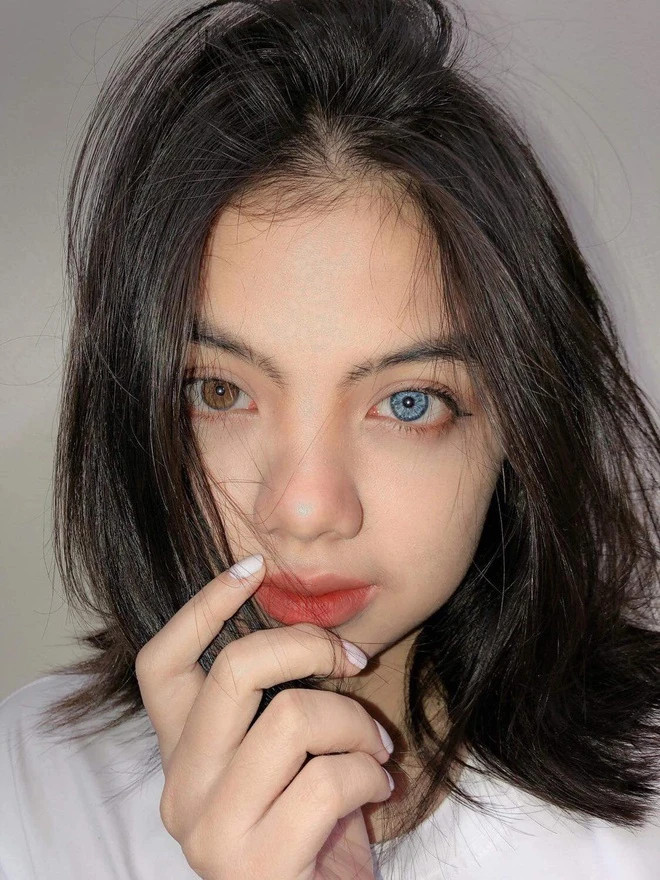 Cô gái Việt sở hữu đôi mắt có 2 màu cực hiếm, bị hiểu nhầm là con lai - ảnh 2
