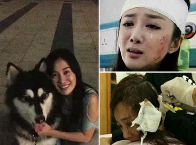 Nữ ca sĩ 17 tuổi bị chó cắn phải nhập viện, tình trạng khiến nhiều người xót xa - ảnh 4