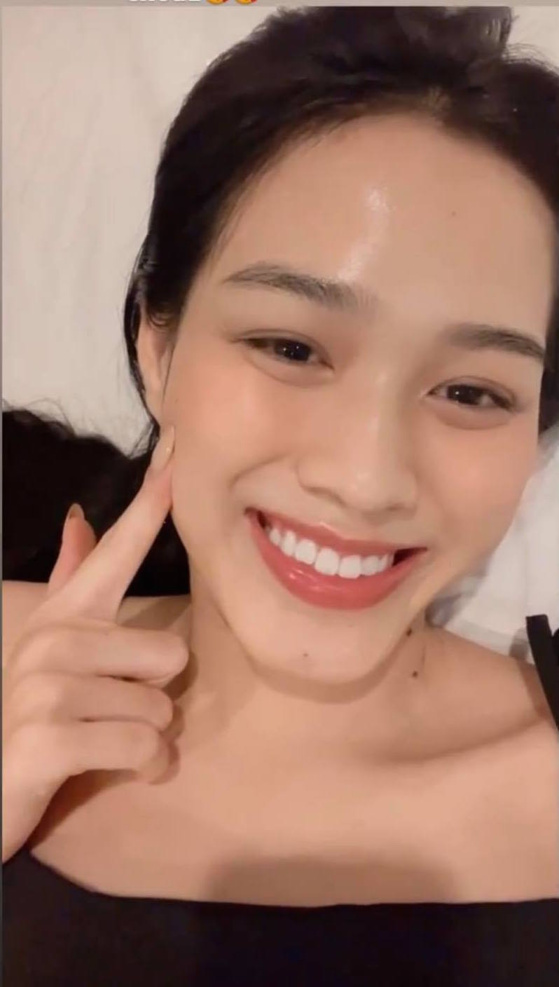 Một nàng hậu Việt gặp sự cố khi chăm da, nhan sắc xinh đẹp bị ảnh hưởng nặng - ảnh 4
