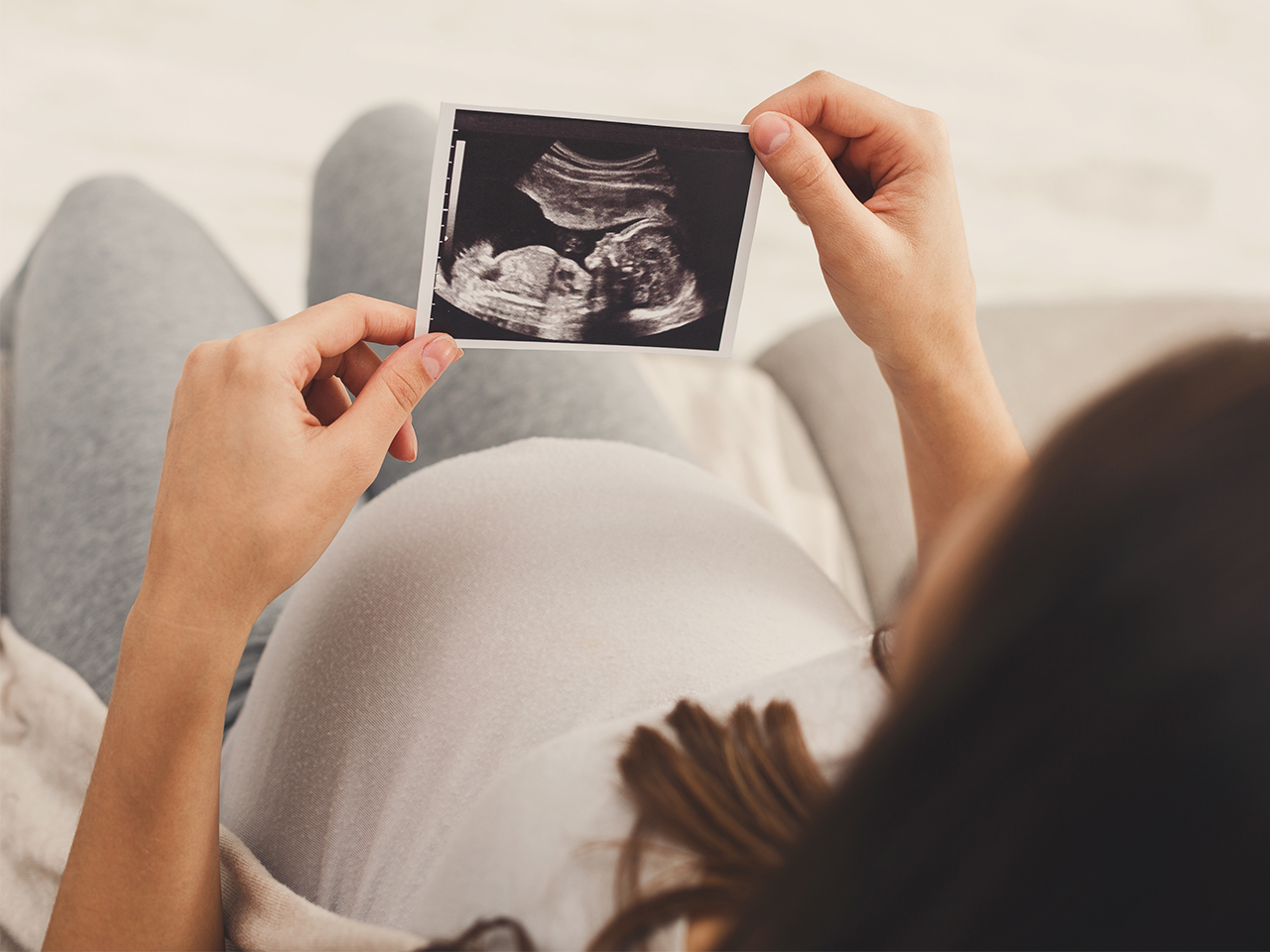 Hy hữu người phụ nữ mang thai ở lá lách, trên thế giới chỉ 39 ca, liệu có sinh con ra được không? - ảnh 2