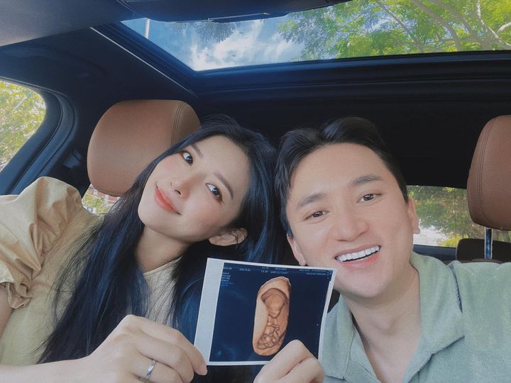 Phan Mạnh Quỳnh và Khánh Vy chia sẻ ảnh chụp siêu âm của em bé cùng thông báo tin vui đến khán giả