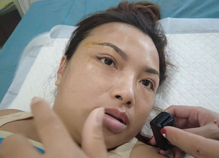 Quỳnh Trần JP quyết định 'dao kéo' ở tuổi U40 vì tự ti ngoại hình sau khi sinh con, được bà Nhân Vlog chăm sóc - ảnh 11