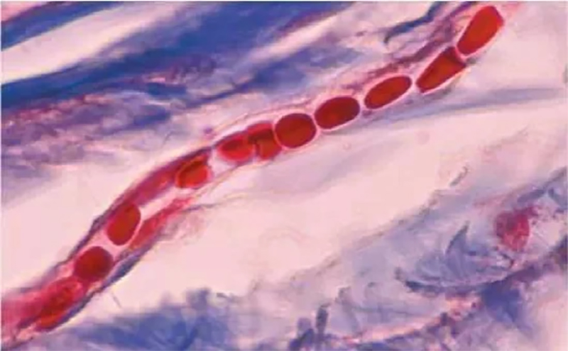 Hình ảnh mô phỏng mao mạch ẩn dưới da