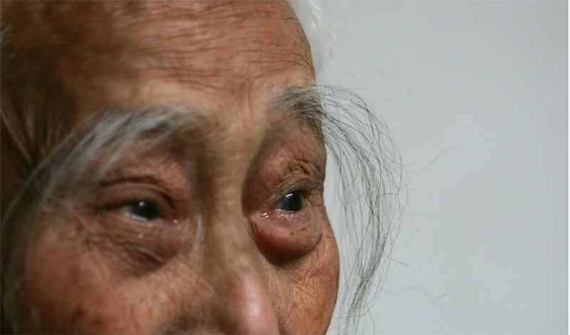 Nhiều người già có lông mày mọc dài khác với bình thường