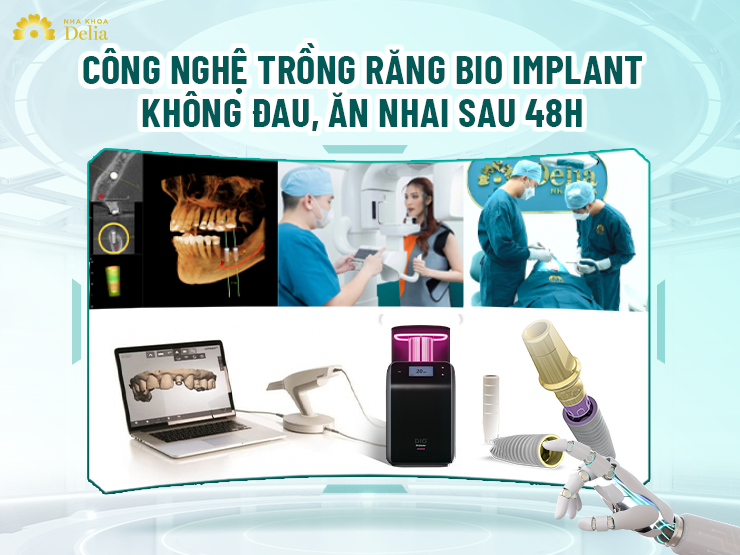 Bio Implant – Đột phá công nghệ trồng răng không đau, ăn nhai sau 48 giờ tại nha khoa Delia - ảnh 1