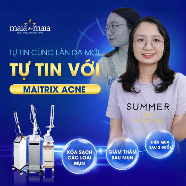 Maia Bắc Ninh địa chỉ điều trị mụn uy tín không nên bỏ qua - ảnh 3