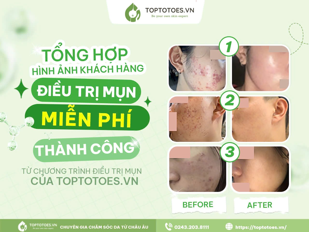 Toptotoes.vn khẳng định vị thế khác biệt trong hành trình chăm sóc da với Liệu trình chăm sóc da cá nhân hóa - ảnh 4