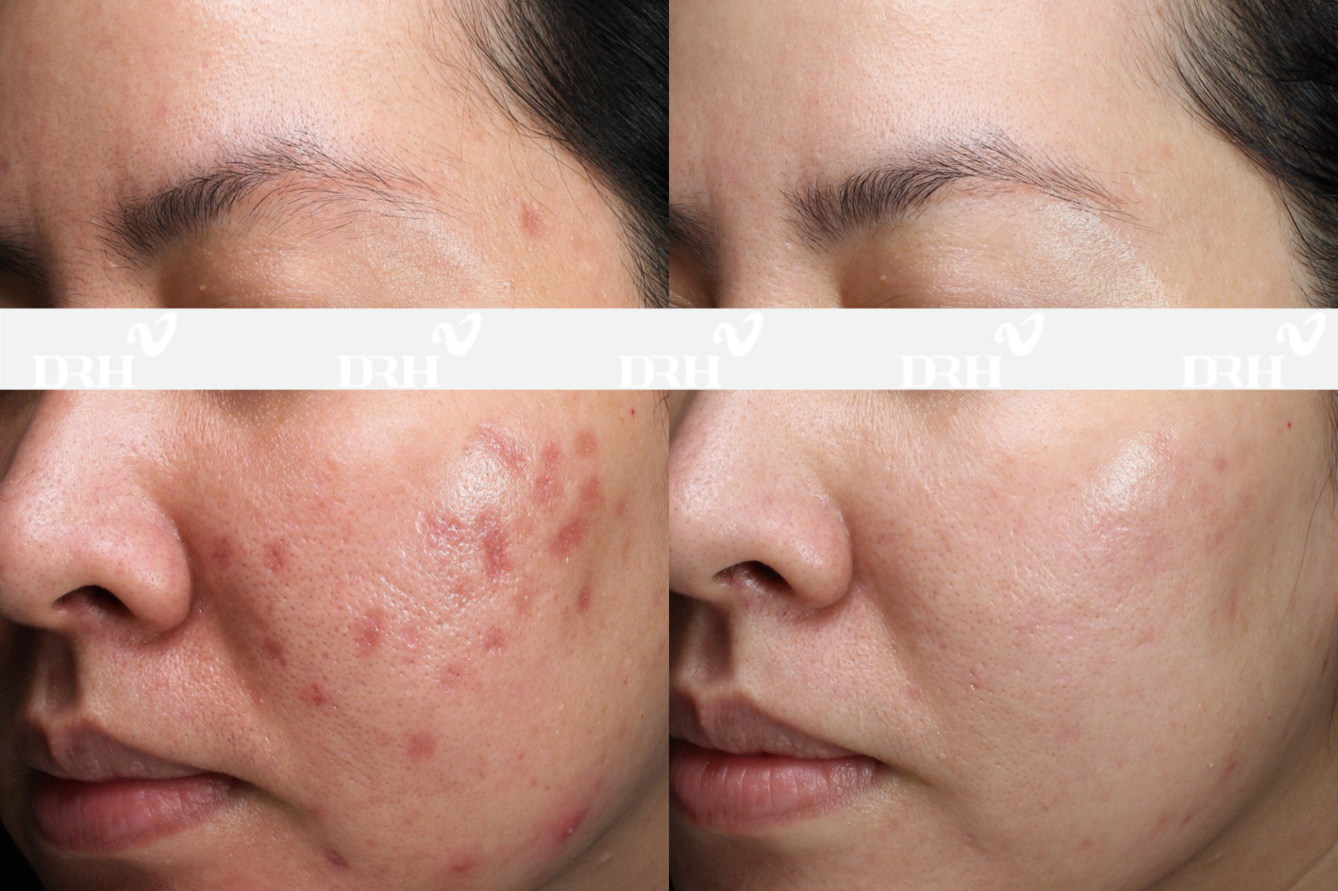 Biến Chứng Tràn Lan, Nhiều Người Việt Chọn DRH Clinic Làm Đẹp An Toàn Bền Vững - ảnh 1