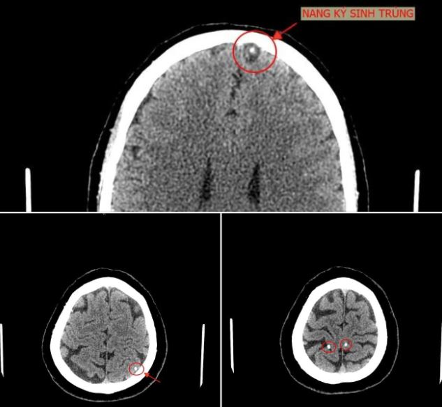 Hình ảnh chụp não của bệnh nhân.