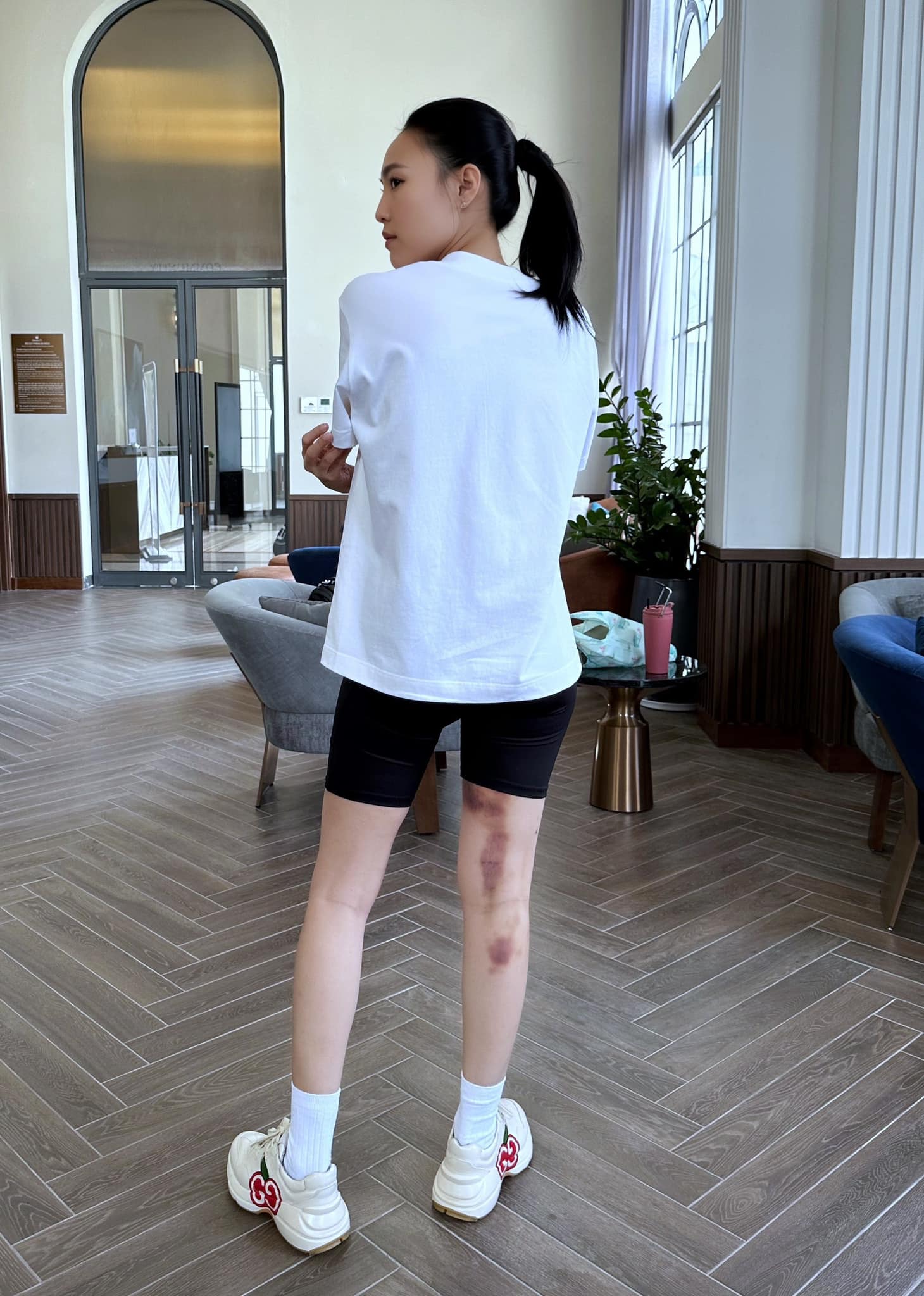 Ninh Dương Lan Ngọc nghi bị bầm chân do quá trình tập luyện để tham gia chương trình 'Chị Đẹp Đạp Gió Rẽ Sóng'