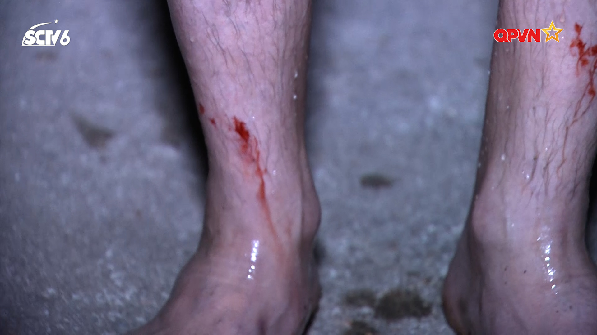 S.T gặp sự cố bơi đêm, chân bị thương rớm máu