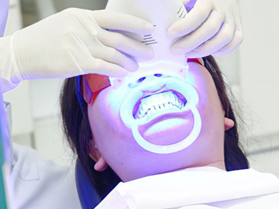 Bí quyết mới từ Nhật Bản giúp người niềng răng không cần tẩy trắng - ảnh 2
