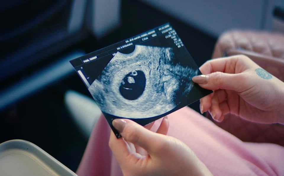 Hương Tràm khoe ảnh siêu âm mang thai ngay ngày sinh nhật, dàn sao Việt 'vội vã' gửi lời chúc mừng - ảnh 1