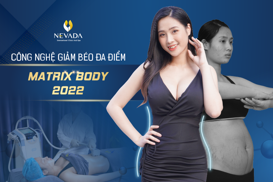 Matrix Body 2022 - lựa chọn giảm béo thông thái cho sức khỏe phụ nữ Việt