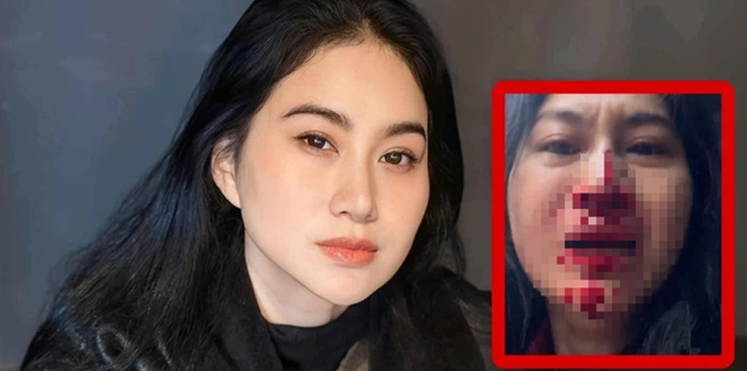 Diễn viên Phi Ngọc Ánh mặt đầy máu, cầu cứu trên livestream - ảnh 2