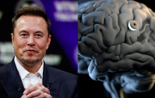 Tỷ phú Elon Musk tiết lộ tình trạng bệnh nhân đầu tiên được cấy chip vào não, 'điều thần kỳ' đã xảy ra?