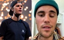 Justin Bieber gây sốc khi bất ngờ tiết lộ bị liệt nửa mặt vì nhiễm virus