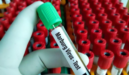 WHO cảnh báo virus Marburg gây tử vong đến 88%: TP.HCM yêu cầu chuẩn bị sẵn phương án ứng phó