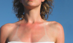 Ngoài da mặt, đây là 9 vùng trên cơ thể nhất định phải thoa kem chống nắng dù trời râm mát
