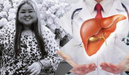 Vụ TikToker Cô Ngọc Béo đột ngột qua đời vì bệnh gan: Bác sĩ cảnh báo thói quen nguy hiểm