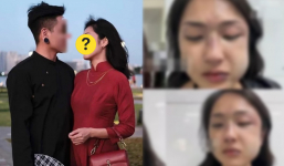 Nữ MC quen mặt showbiz Việt từng tố bạn trai cũ “tác động vật lý” trầm trọng, tình hình hậu biến cố ra sao?