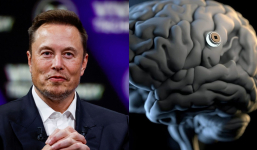Tỷ phú Elon Musk tiết lộ tình trạng bệnh nhân đầu tiên được cấy chip vào não, 'điều thần kỳ' đã xảy ra?