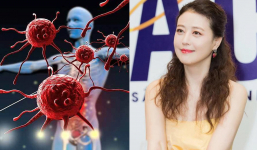 Sự nguy hiểm của bệnh lupus ban đỏ mà diễn viên nổi tiếng Châu Hải My mắc phải trước khi qua đời
